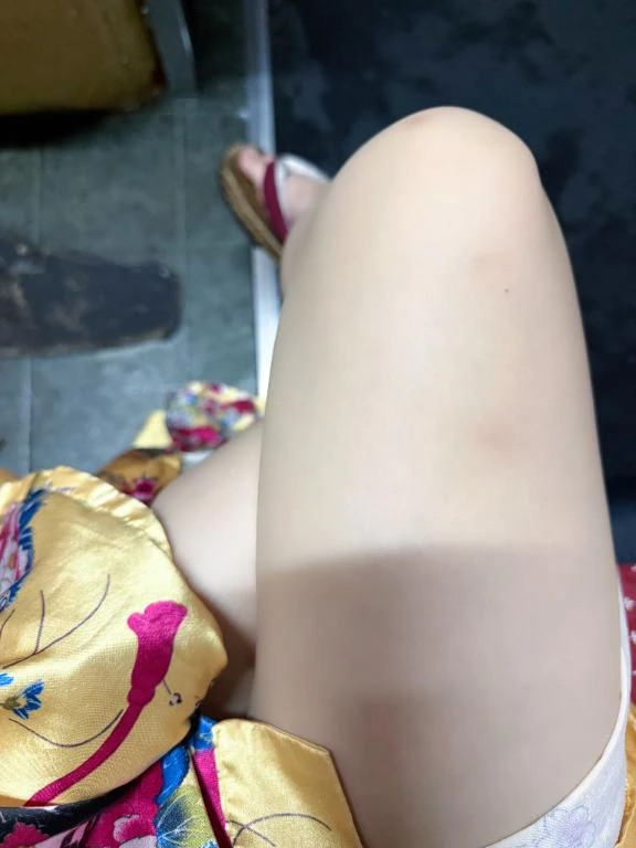 うるる